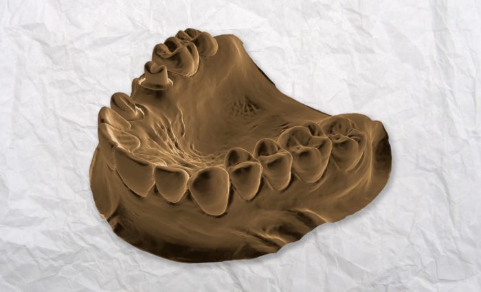 3D tooth mark